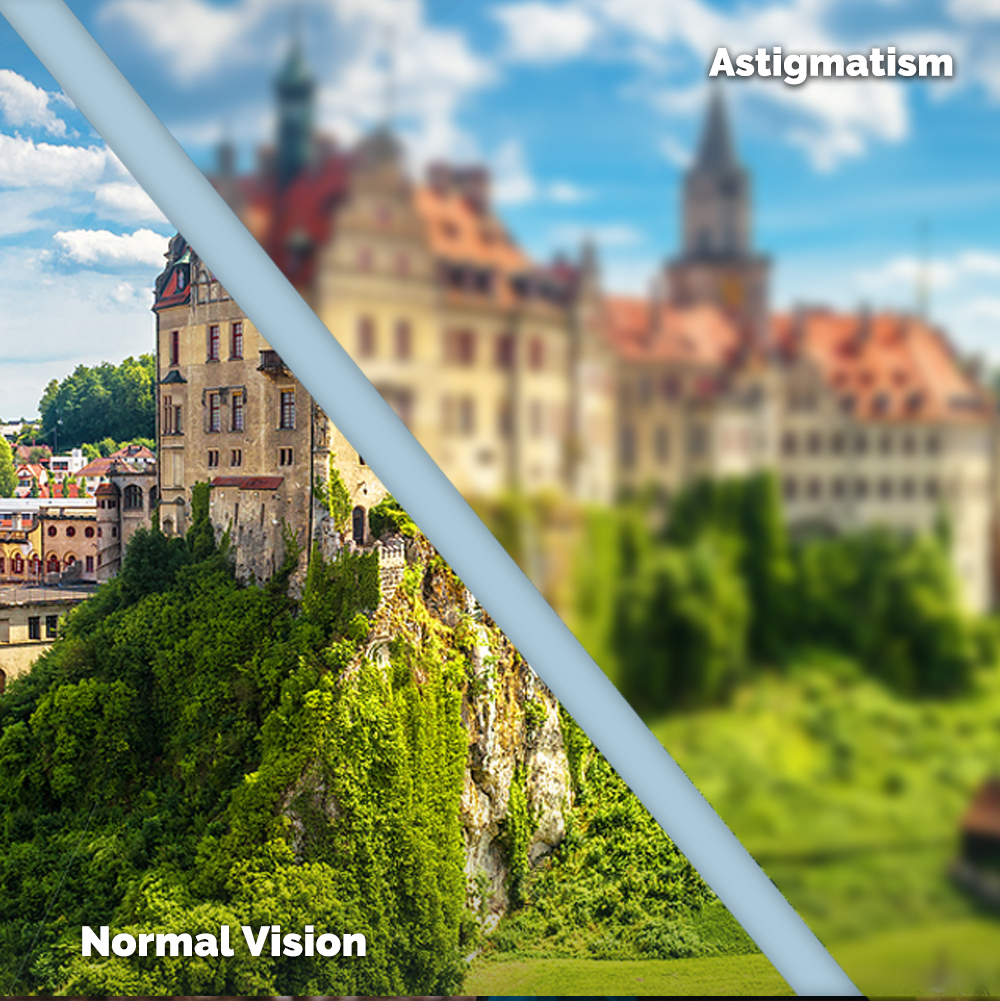 Astigmatism Treatment in Lakewood Hills
