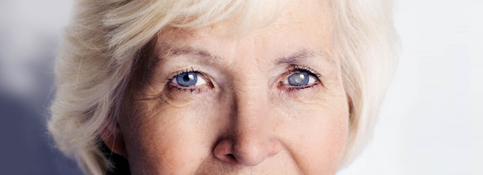 Cataract Surgery in Lakewood Hills